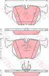 TRW SFP000120 SFP000120